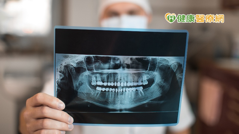 牙科拍攝X光輻射曝露恐害健康？　食藥署出面解析